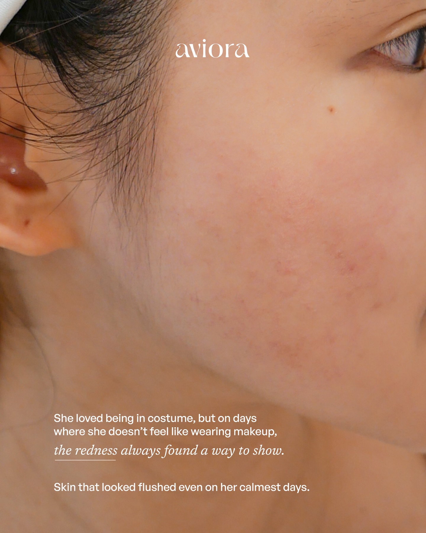Franzeska — Skin Diaries slide 2